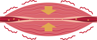 筋肉の使い過ぎ