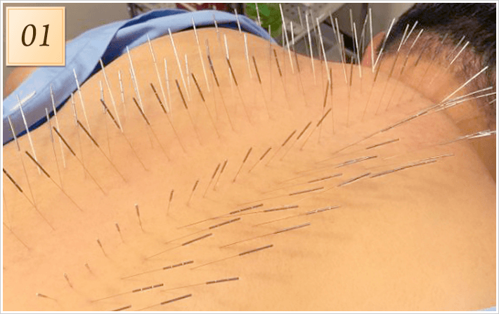 専門性の高い技術